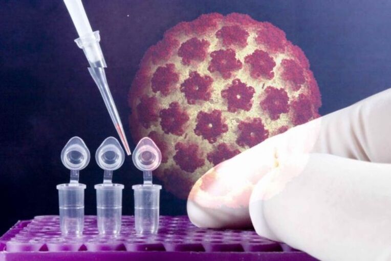 Testy na HPV